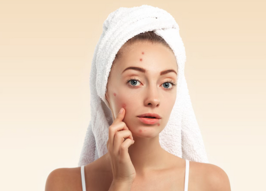 vitamin-c-serum-for-acne-scars
