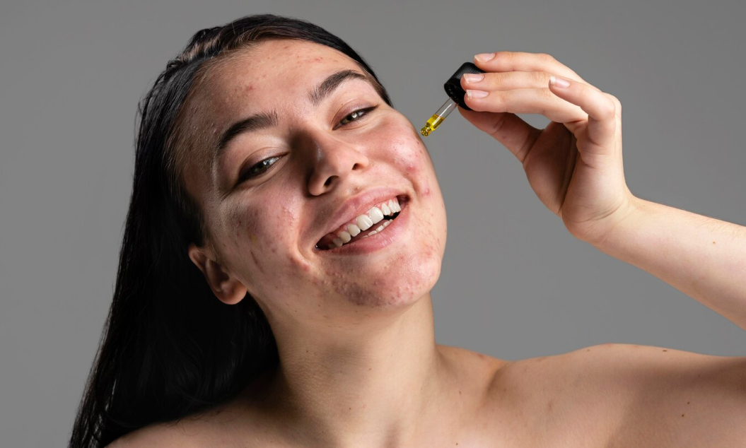does vitamin c serum cause breakouts