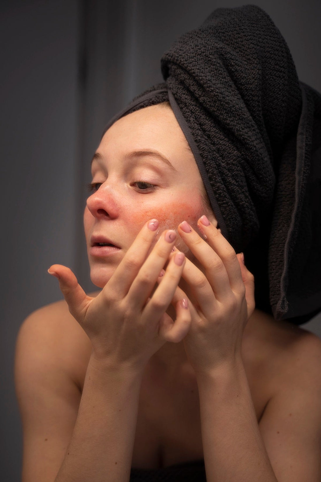 damaged skin barrier