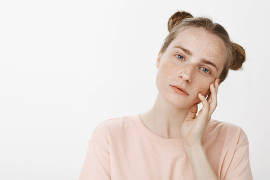 dull skin