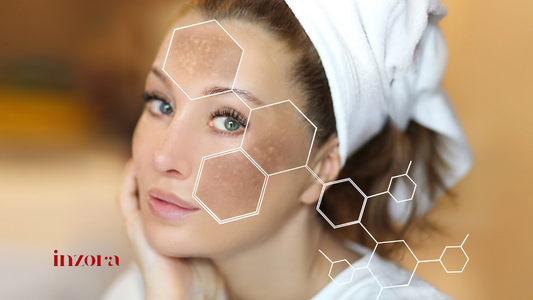 how to remove hyperpigmentation