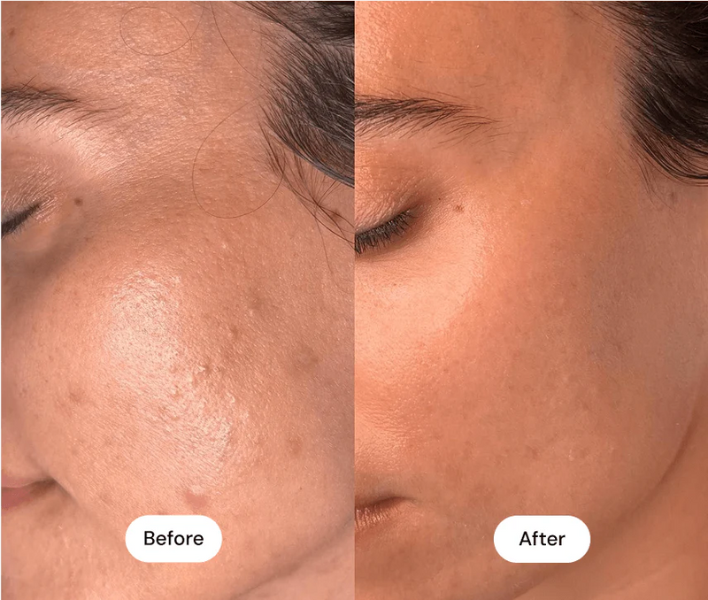 Before using the product